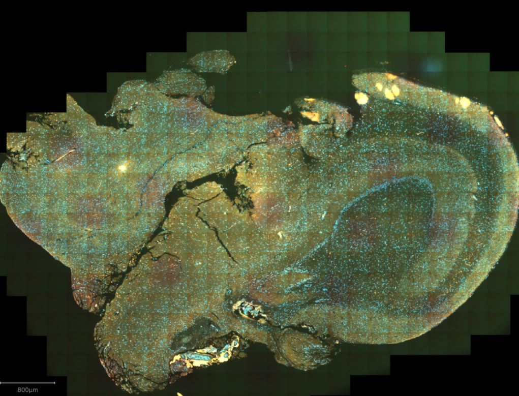 Fluorescent whole slide scans of the epileptic hippocampus.