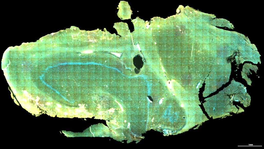 Fluorescent whole slide scans of the epileptic hippocampus.