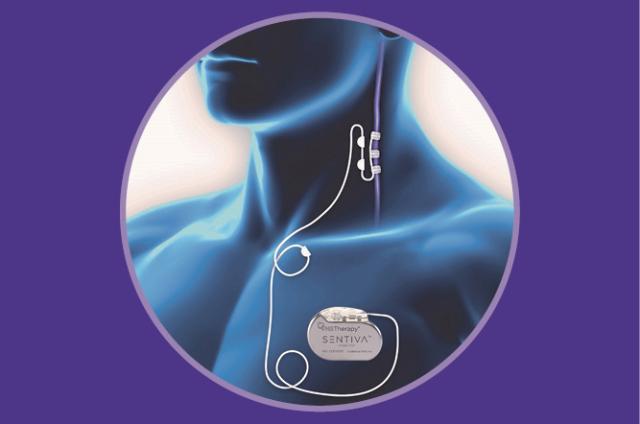 Vagus Nerve Stimulation (VNS) Therapy banner